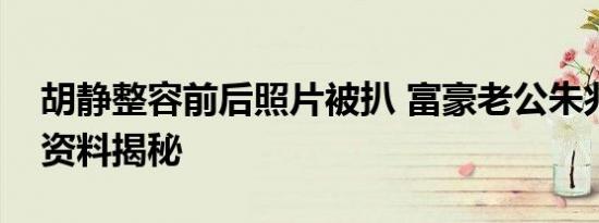 胡静整容前后照片被扒 富豪老公朱兆祥个人资料揭秘