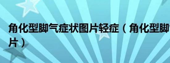 角化型脚气症状图片轻症（角化型脚气症状图片）